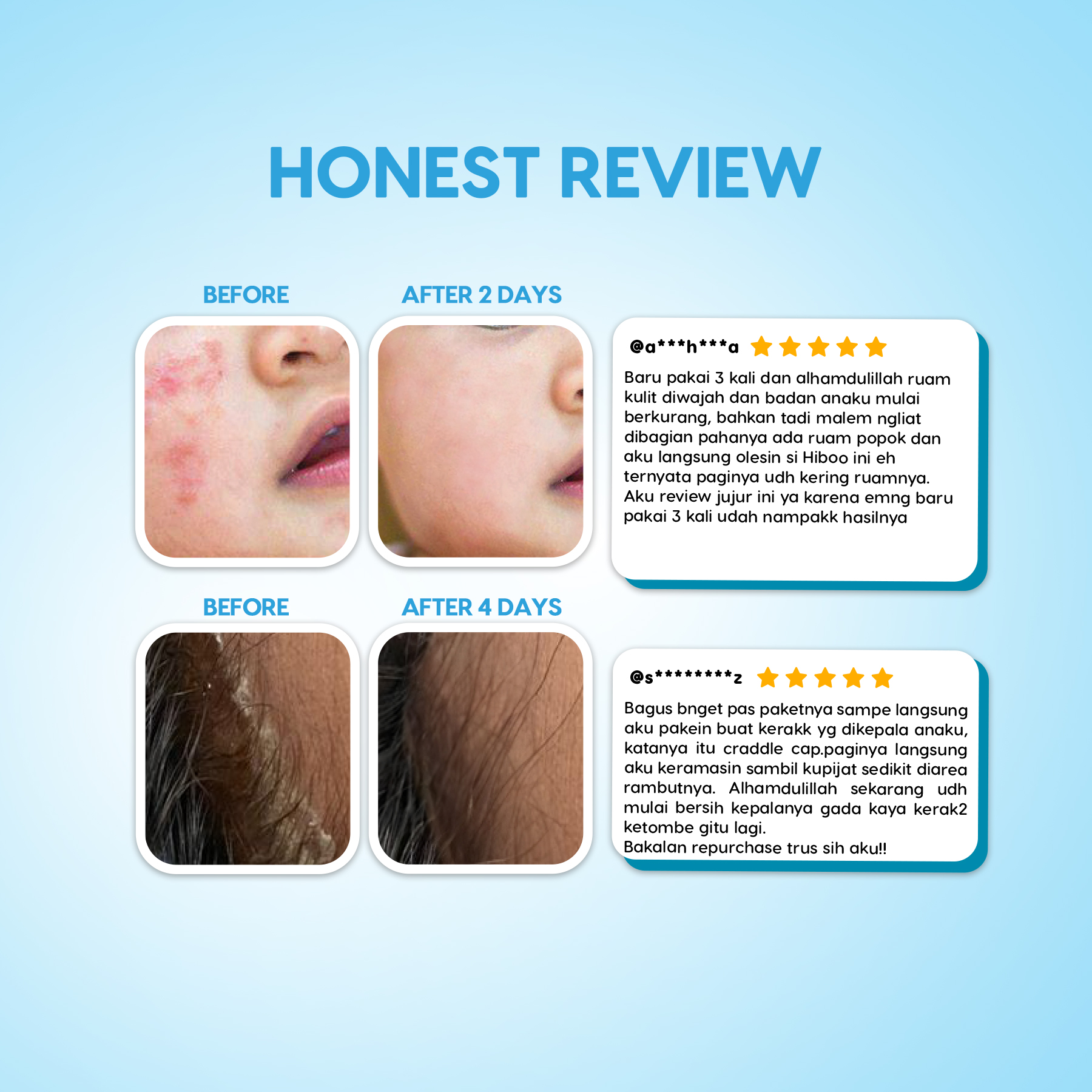 Honest Review Baby Balm — 10RB+ Testimoni