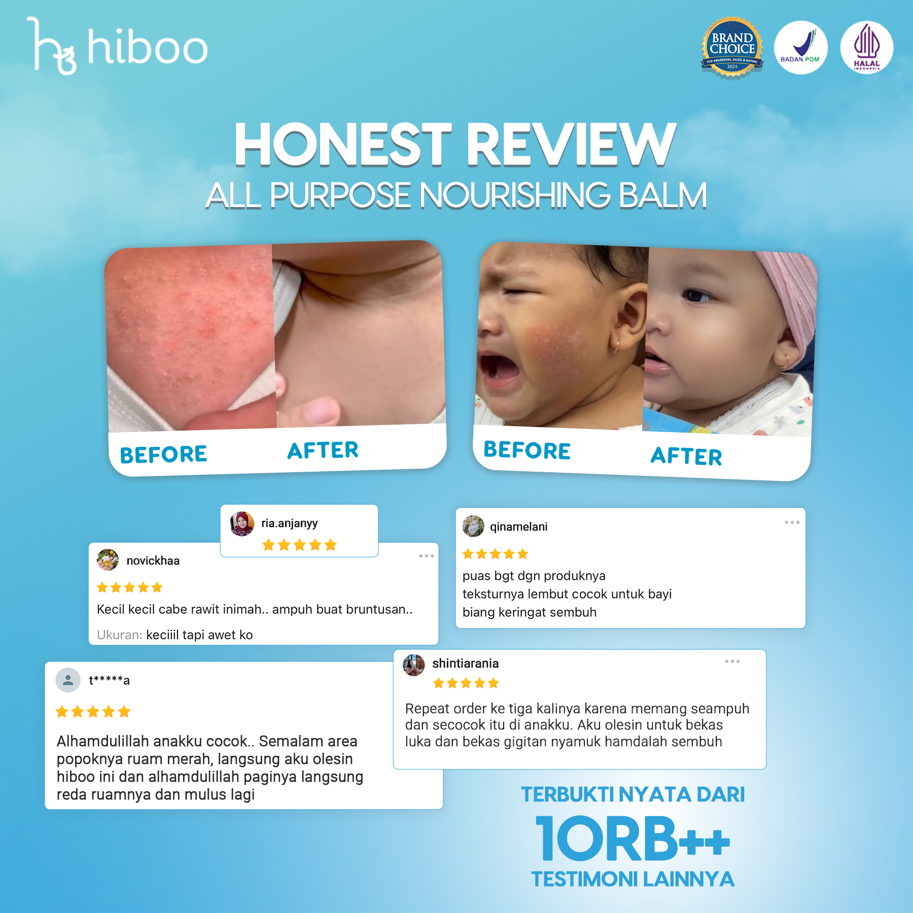 Hiboo All Purpose Baby Balm with 10% Coconut Oil + Vit E + Beeswax