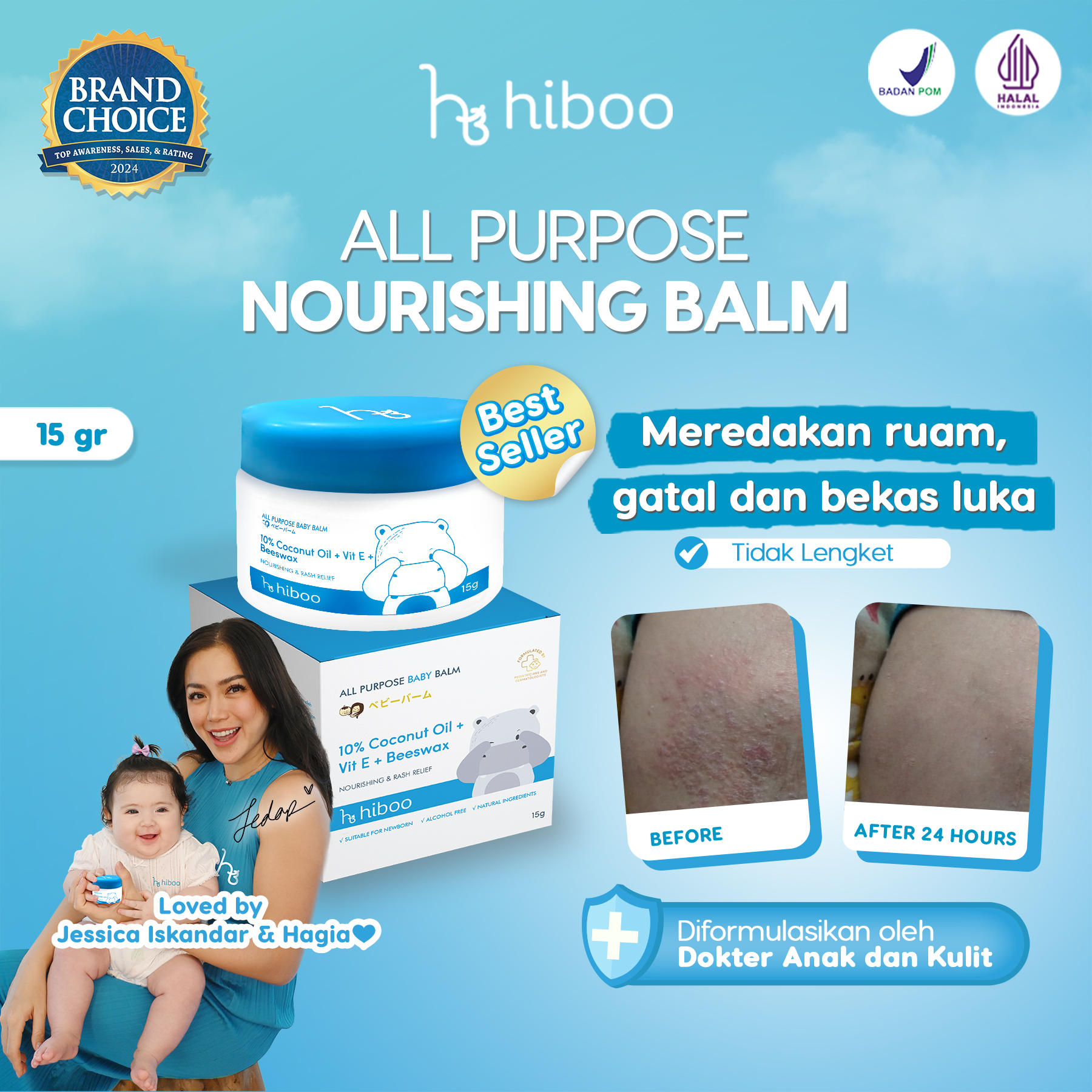 Hiboo All Purpose Baby Balm with 10% Coconut Oil + Vit E + Beeswax - 15 gram